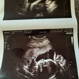 Meet your Posher, Shilo